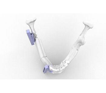 Kune - Model PEEK - Custom Implant for Maxilofacial Surgery