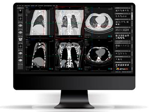 Alma - Multiplanar Reconstruction (MPR) - Workstation - DICOM Viewer By ...