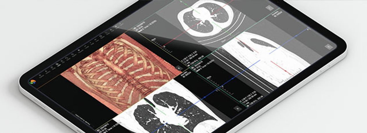 Alma - Version mCLINIC v2.0 - Web-Based Solution for Medical Image Visualization and Analysis