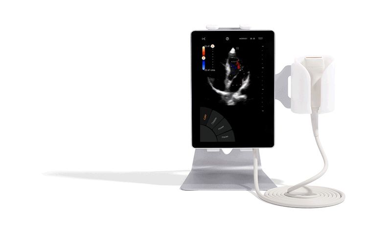 Sonoscanner - Model U-Lite - Ultra-Portable Ultrasound