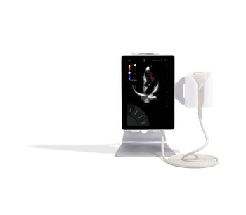 Sonoscanner - Model U-Lite - Ultra-Portable Ultrasound