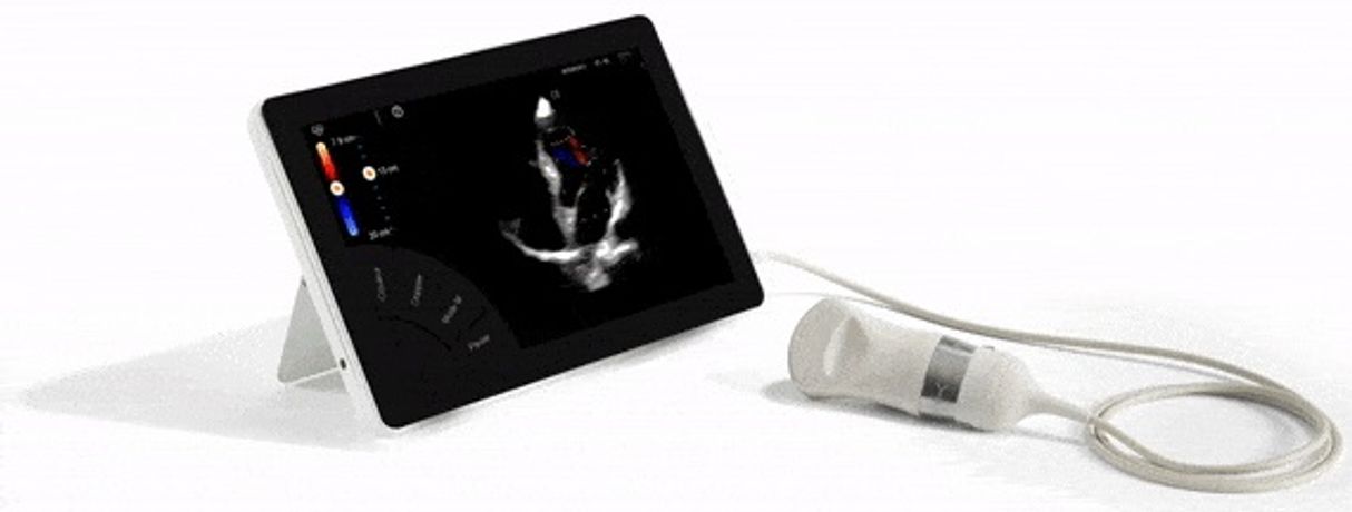 Sonoscanner - Model T-Lite - Ultraportable Ultrasound Scanner