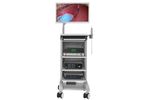 DeepEye - Model EVS100 - 2D Video Endoscopy System