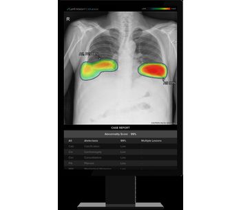 Lunit - Version INSIGHT CXR - AI Solution for Chest X-ray