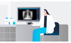 [EN] What do the medical journals say about AI-powered chest x-ray interpretation? | Lunit - Video