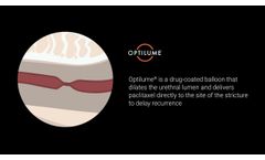Optilume® Urethral Drug Coated Balloon for Urethral Stricture Treatment - Animation, How it Works - Video