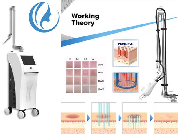 What skin problems can CO2 fractional laser solve-0