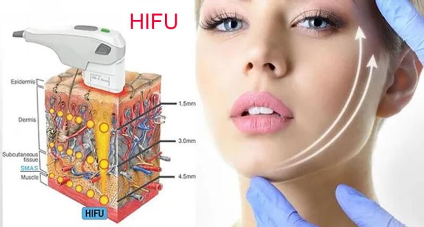 Post-treatment care after HIFU ultrasound cosmetic treatment-1