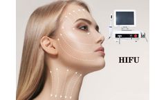 HIFU ultrasound face lifting treatment principles and safety