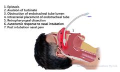 Complications of Nasal Endotracheal Intubation - Video