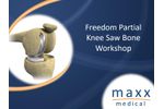 Freedom Renew - Resurfacing Unicondylar Total Knee System - Surgical Technique - Brochure