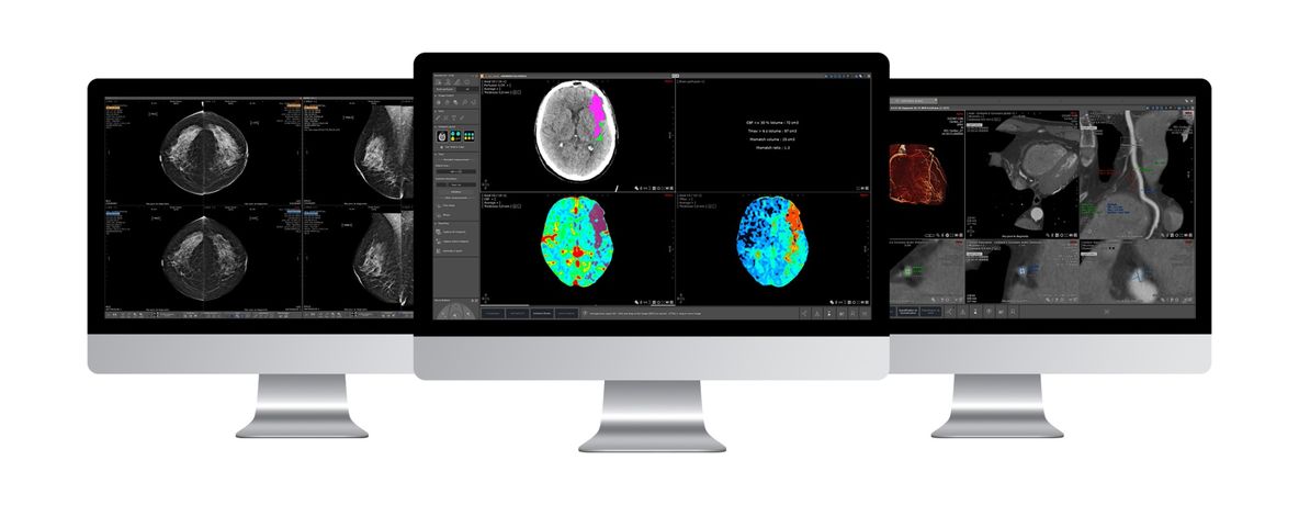 Myrian - Version 2.9 - Software for Medical Imaging Layer