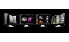 Myrian® - Version 2.13 - Software for Medical Imaging Layer