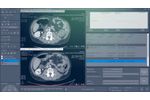 Myrian - Version XP-Onco/Liver/Prostate/Colon/Abdofat - Optimize Multi-Modality Oncology Software