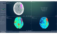 Myrian - Version XP-Brain - Head Perfusion CT