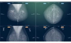 Myrian - Version XP-Breast, XP-Mammo and XP-Female Pelvis - Mammography, Tomosynthesis, Breast MRI Or Ultrasound Examinations