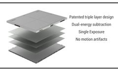 Reveal: Portable Single Exposure Dual-Energy X-Ray Detector - Video