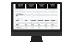NeuroQuant - Version MS - FLAIR Lesion and Atrophy Report Software