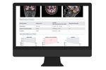 NeuroQuant - Version MSA - Multi-Structure Atrophy Report Software
