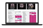 NeuroQuant - Version TBA - Triage Brain Atrophy Report Software