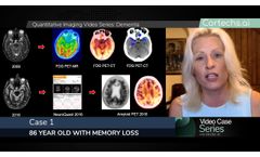 Quantitative Imaging for Dementia - Case review with Dr. Bash - Video