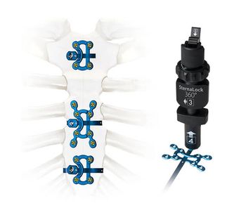 Sternalock - 360 - Sternal Closure - Sternal Rigid Fixation - Sternal ...