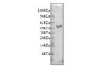 Ampersand - Model ANGPTL7 -P4011 - Recombinant Human Protein