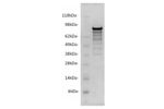 Ampersand - Model CgB -P4007 - Recombinant Human Protein