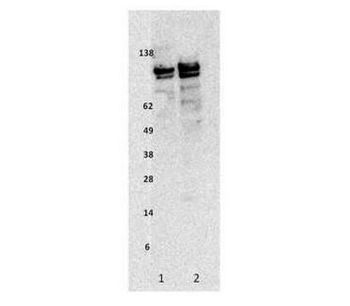 Ampersand - Model R3006 - Ceruloplasmin Human, pAb ( aff pur) Antibodie