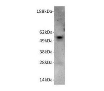 Ampersand - Model CgA mAb (cGA-2G8) M2009 - Human Antibodie