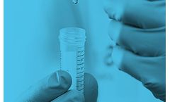 Sentrx - Model BioHAnce - Ophthalmology and Epidermal Repair Technology