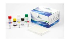 Calbiotech - Model T1244A - Immunoglobulin E (IgE) ELISA