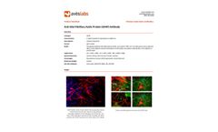 Aves - Anti-Glial Fibrillary Acidic Protein Antibody (GFAP) - Brochure