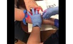 Student Nurse uses Veinlite LED+ on First Stick - Video