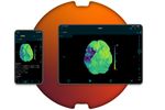 Brainomix - Version e-CTP - Robust, Reliable CT Perfusion Results
