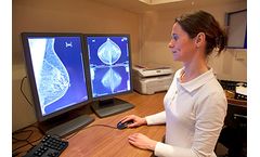 Breast Imaging Services