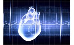 Cardiac Screening Services