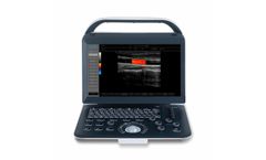 Welld - Model C50 - Color Doppler Ultrasound Scanner