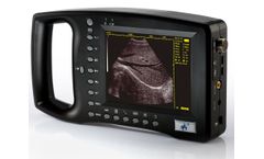 Welld - Model WED-3100 - Palm-Size Full-Digital Ultrasound Diagnostic System