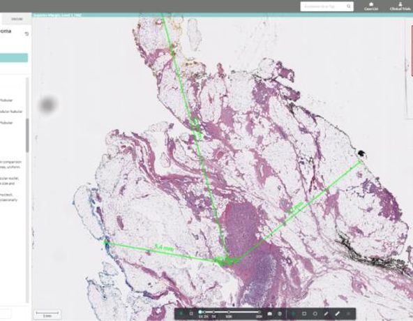 Halo - Version AP - Anatomic Pathology Workflow Software