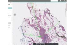 Halo - Version AP - Anatomic Pathology Workflow Software