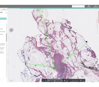 Halo - Version AP - Anatomic Pathology Workflow Software
