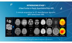 STAGE Imaging: A New Frontier in Rapid, Quantitative Brain Imaging - Video