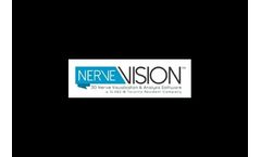 NerveVision - Spinal Nerve Display Solution