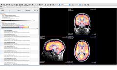 VivoQuant - Image Analysis and Quantitative Analytic Software