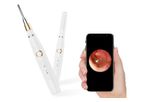 Protege Medical - 3.9MM Wireless Ear Cleaning Endoscope