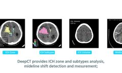 DeepCT - AI identification of ICH and other critical findings - Video