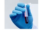 AlphaLiquid - Model Detect - Tumor-Informed, Hybrid-Capture NGS-Based Liquid Biopsy Test