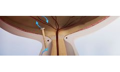 LIQID - Model iPortVR - Vitreoretinal Glaucoma Device