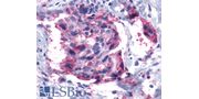 Polyclonal Rabbit anti-Human LTB4R2 / BLT2 Antibody (Cytoplasmic Domain, IHC)
